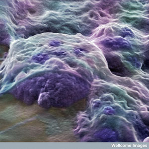 인간 배아에서 유래하는 이 배아줄기세포는 어떤 세포 유형으로든 변할 수 있어. 하지만 구하기 어렵고 헌팅턴병을 직접 치료하는 데 사용될 수 없어.