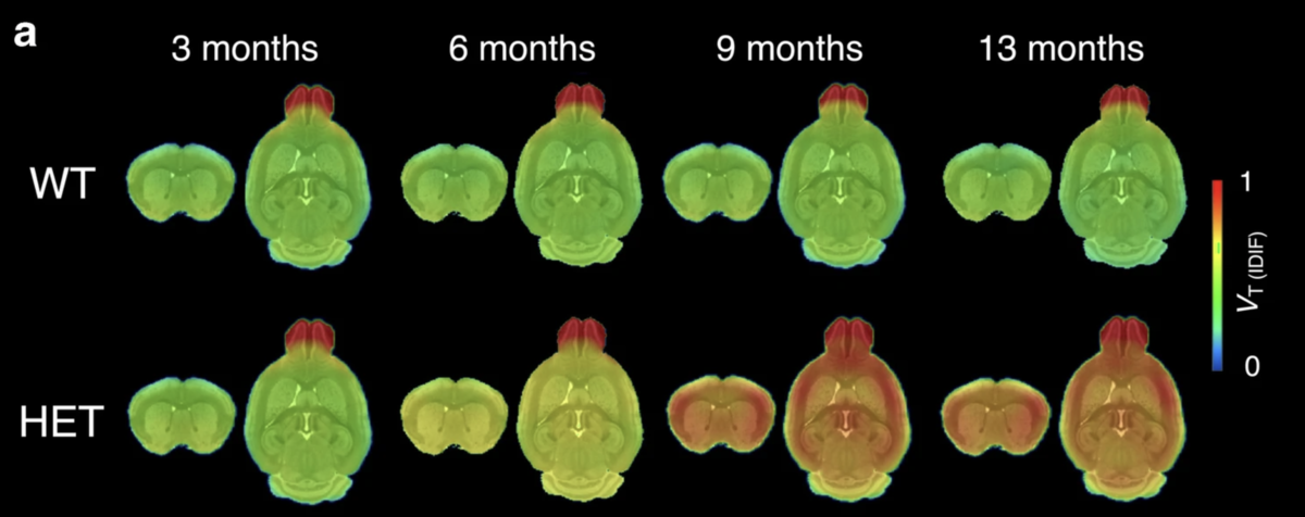 HD가 없는 쥐의 경우 나이가 들어도 뇌 영역에 불이 켜지지 않는 반면 HD 쥐의 경우 과학자들은 나이가 들어감에 따라 HD 쥐의 뇌에 덩어리가 쌓이는 것을 추적할 수 있었습니다. 뇌는 시간이 지남에 따라 빛을 발합니다.  