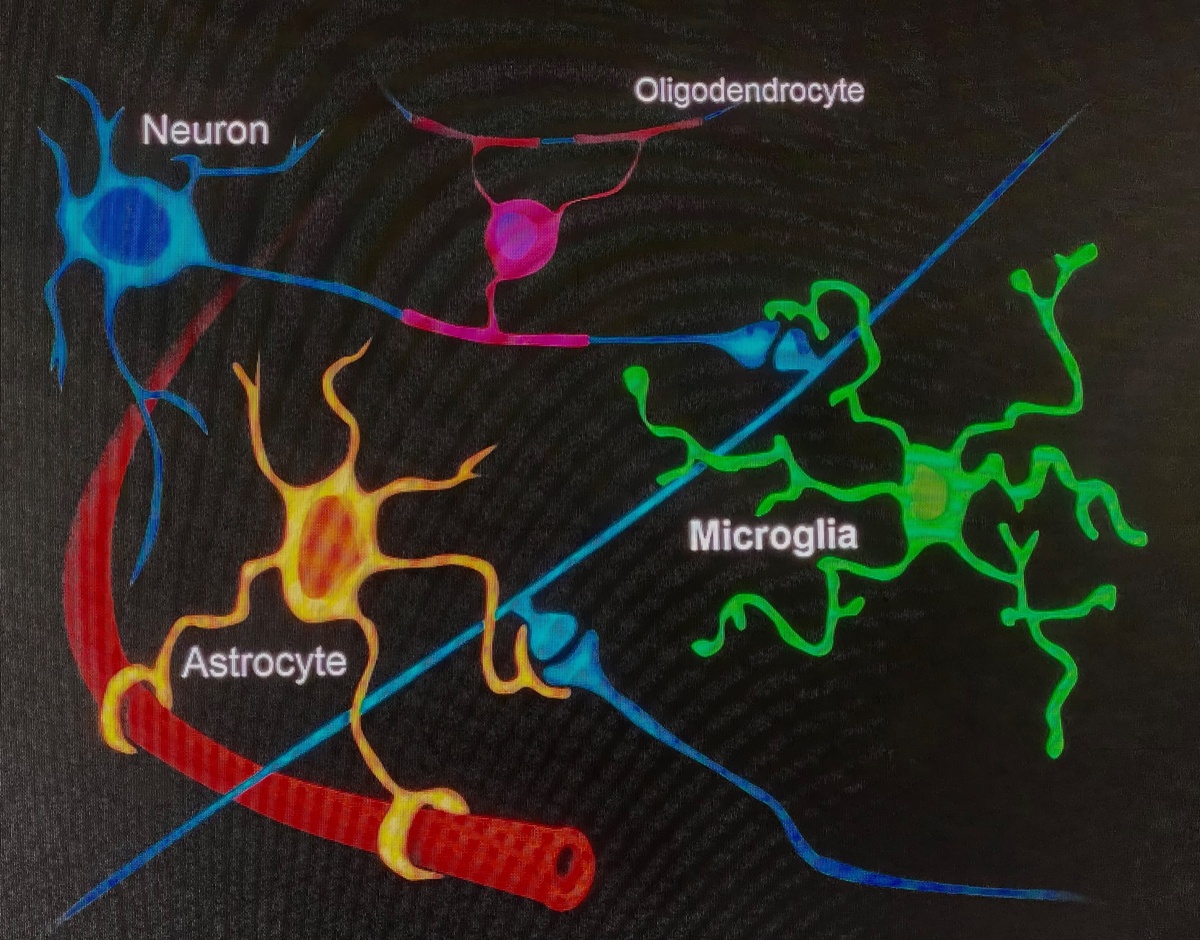Microglia는 뇌의 면역 체계로 작용합니다.  